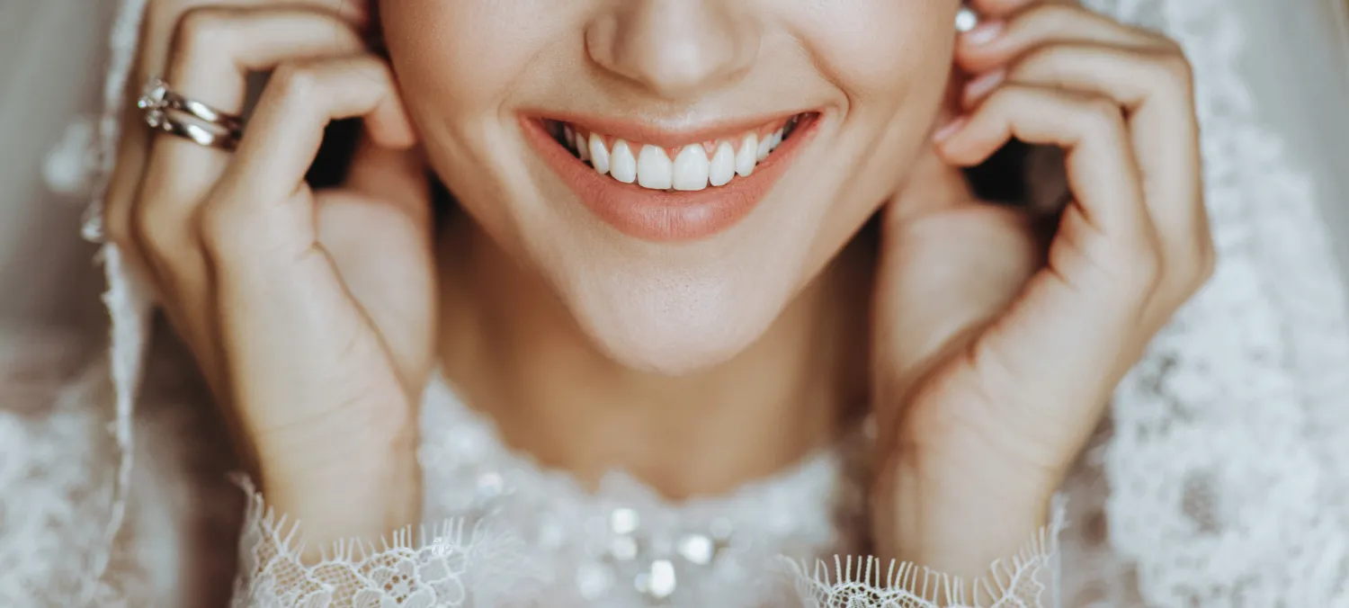 La sonrisa que lo cambia todo: los 3 tratamientos que arrasan antes de bodas, comuniones y eventos