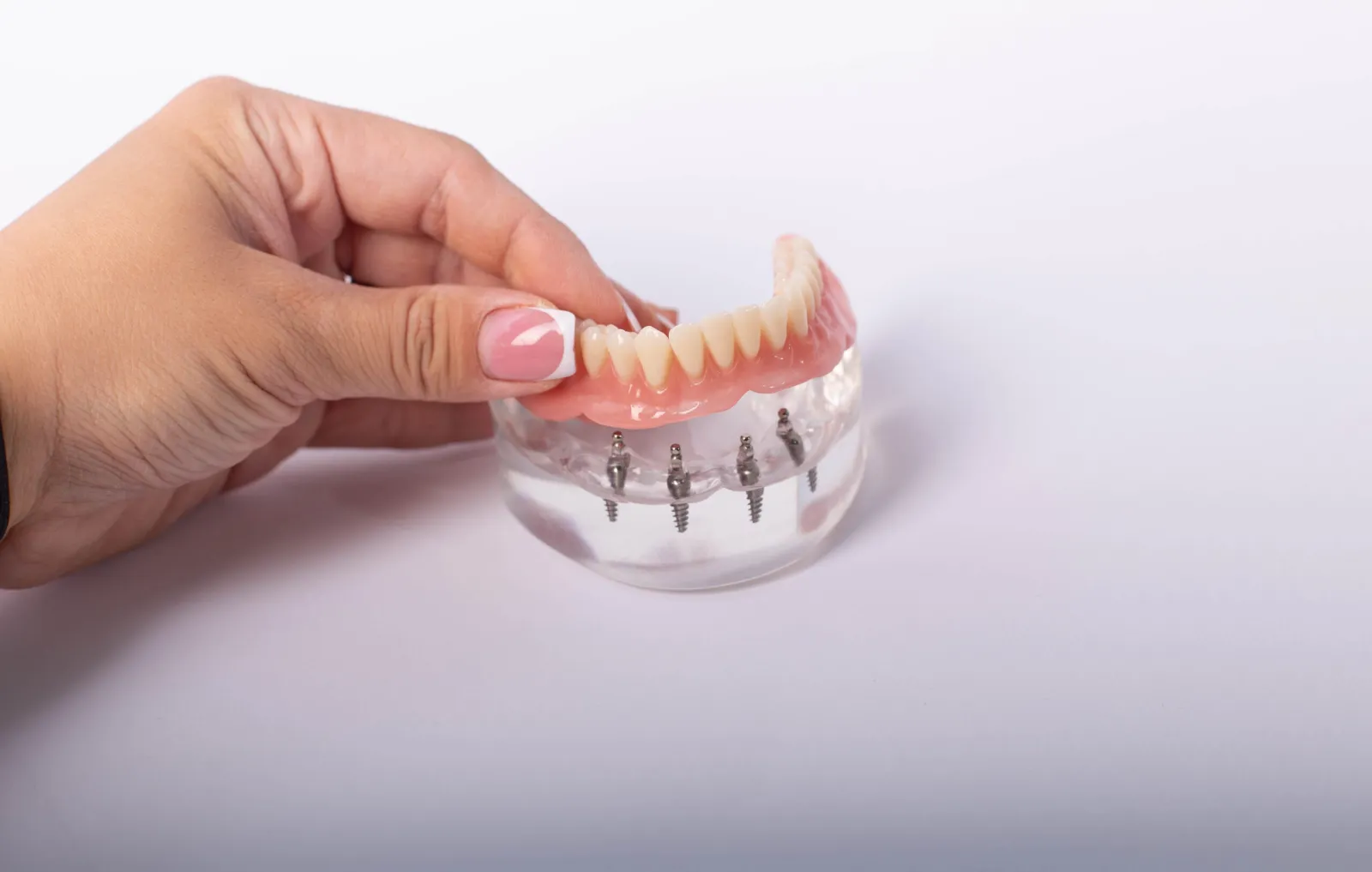 Dientes fijos en el día en Alcalá de Henares