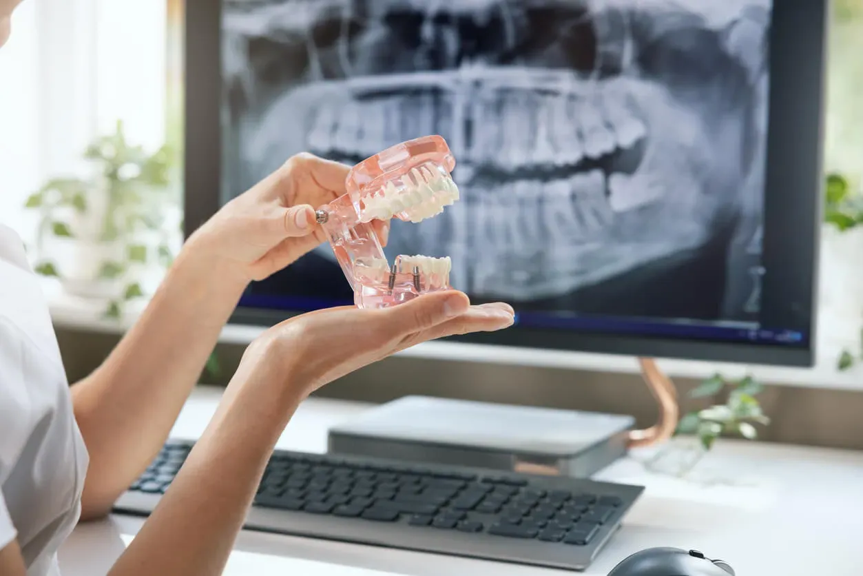 Implantes dentales en Coslada