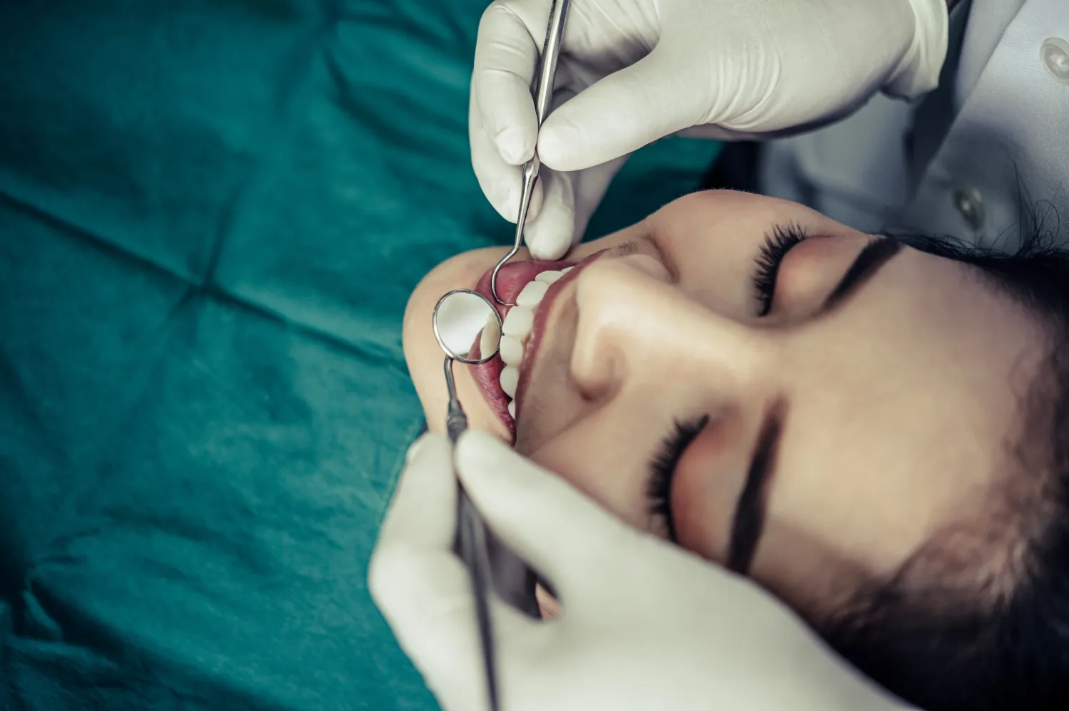 Sedación dental en Alcázar de San Juan