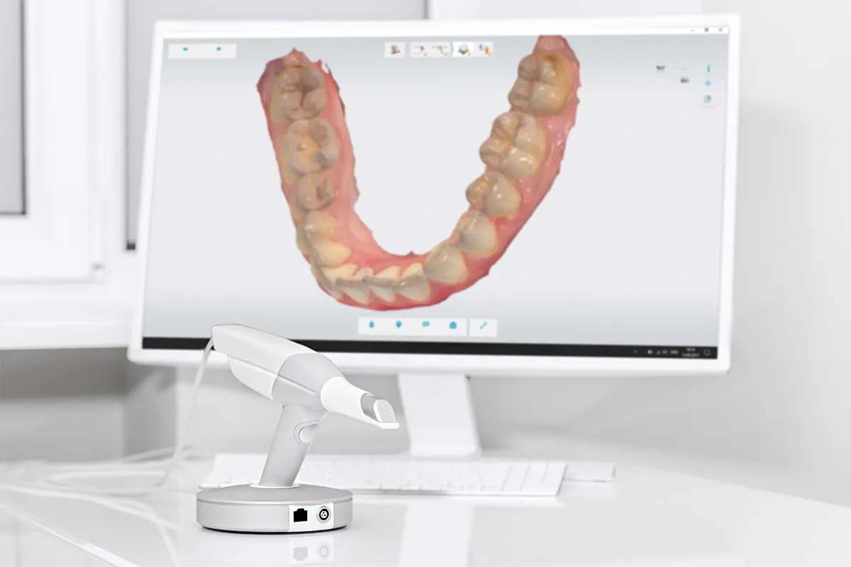 La revolución digital en odontología: la tecnología que transforma tu sonrisa en Clínicas Catalano